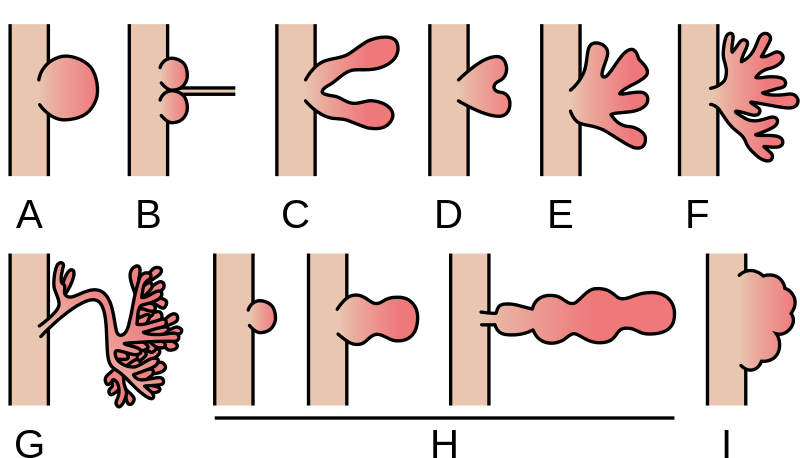 File:Root Nodule Morphologies.svg
