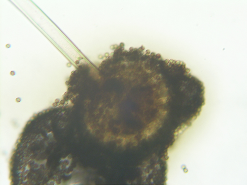 File:Aspergillus conidiophore 160X.png