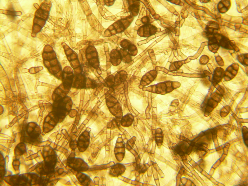 File:Alternaria spores 160X.png