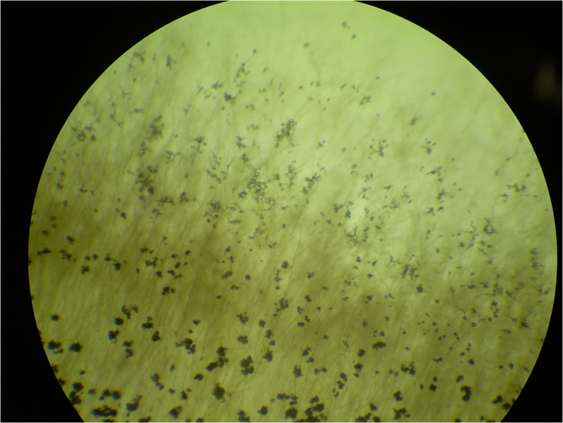 File:Aureobasidium spores 4.5X.png