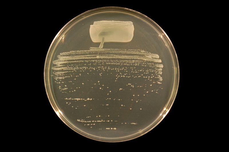 File:Rhizobium tropici strain BR816 on TY agar.JPG