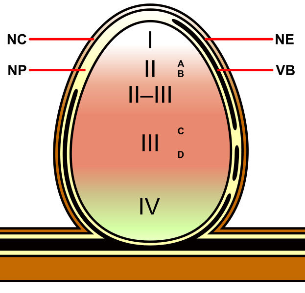 File:Indeterminate Nodule Zones Diagram.svg