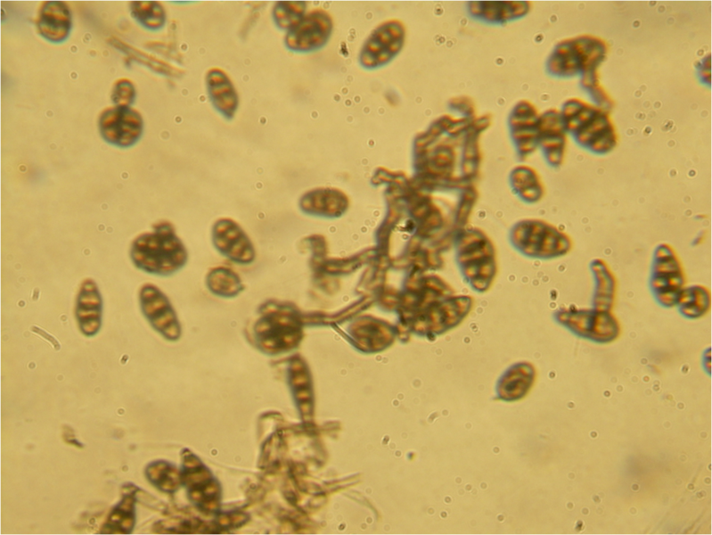 File:Pithomyces spores 160X.png
