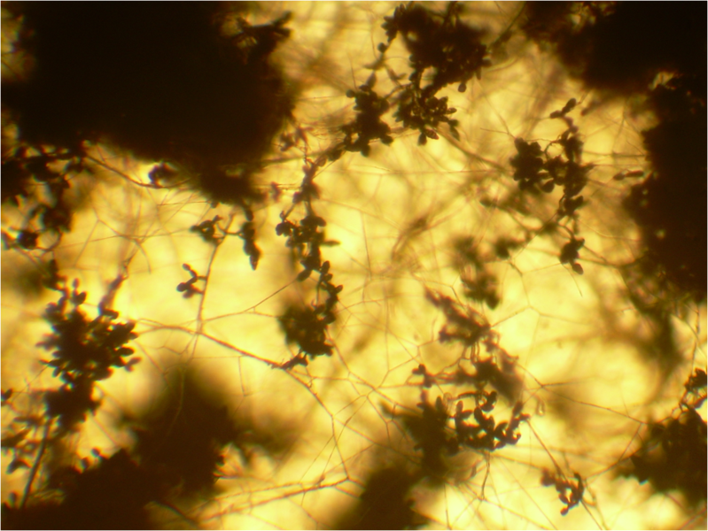 File:Pithomyces conidiophores 40X.png